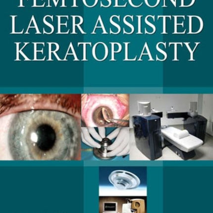 Femtosecond Laser Assisted Keratoplasty