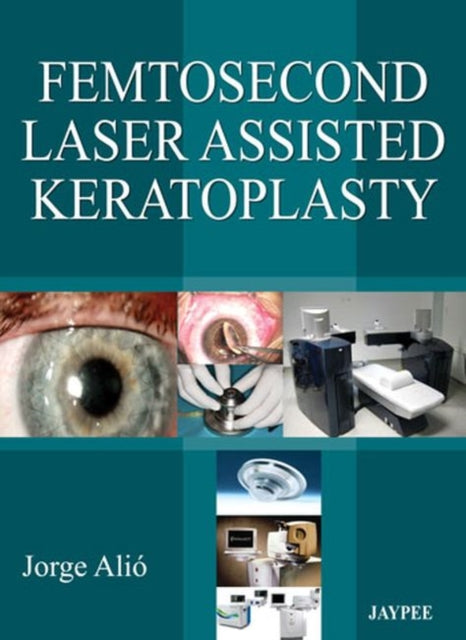 Femtosecond Laser Assisted Keratoplasty