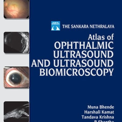 Atlas of Ophthalmic Ultrasound and Ultrasound Biomicroscopy