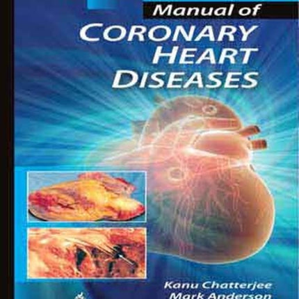 Manual of Coronary Heart Diseases