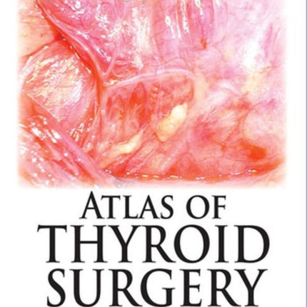 Atlas of Thyroid Surgery