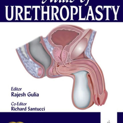 Atlas of Urethroplasty