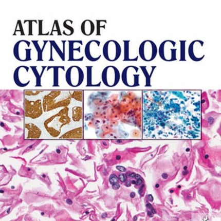 Atlas of Gynecologic Cytology