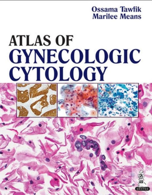 Atlas of Gynecologic Cytology