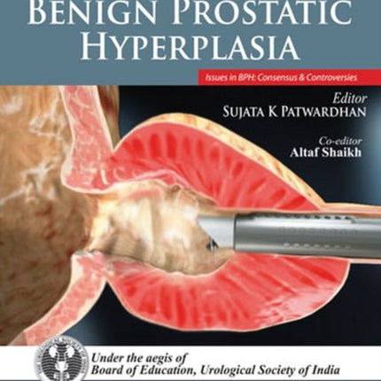 Common Urologic Problems: Benign Prostatic Hyperplasia