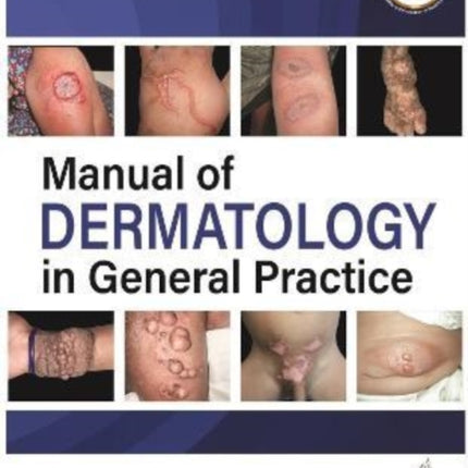 Manual of Dermatology in General Practice