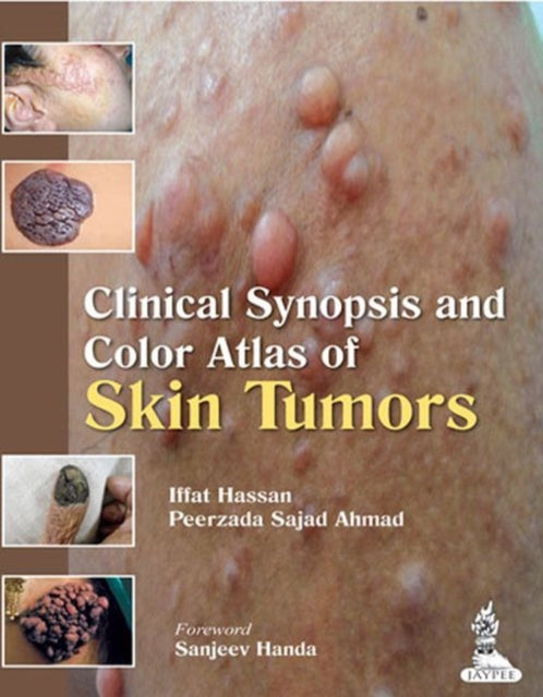 Clinical Synopsis and Color Atlas of Skin Tumors