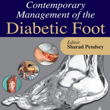 Contemporary Management of the Diabetic Foot