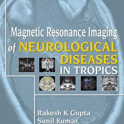 Magnetic Resonance Imaging of Neurological Diseases in Tropics