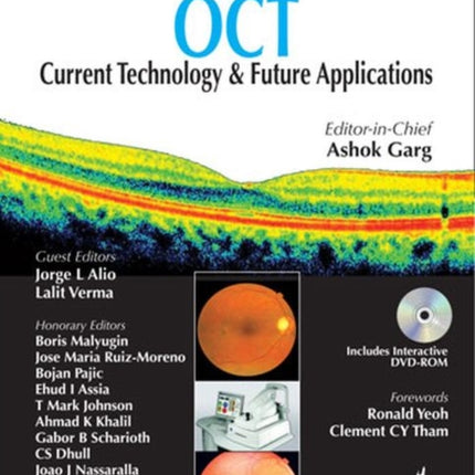 Anterior & Posterior Segment OCT: Current Technology & Future Applications