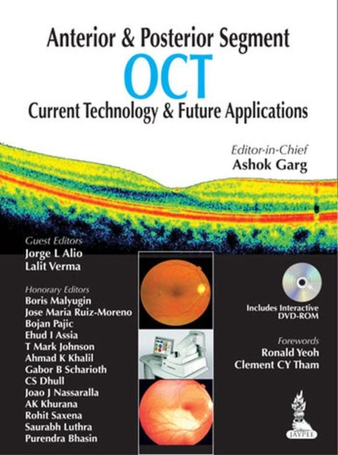 Anterior & Posterior Segment OCT: Current Technology & Future Applications