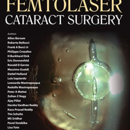 Femtolaser Cataract Surgery