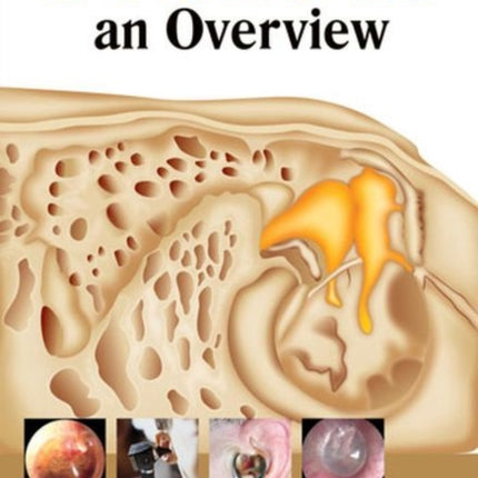 Otology: an Overview