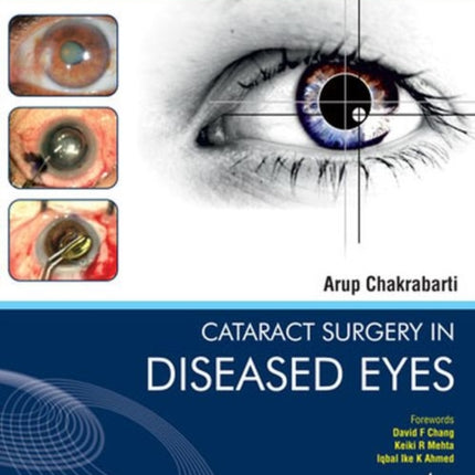 Cataract Surgery in Diseased Eyes