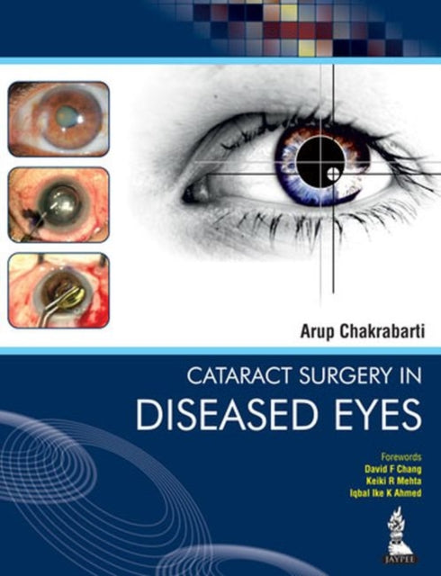 Cataract Surgery in Diseased Eyes