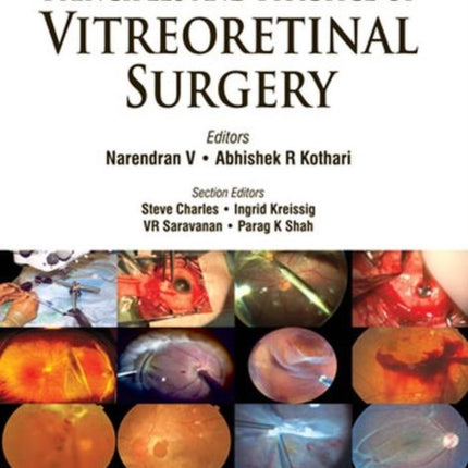 Principles and Practice of Vitreoretinal Surgery