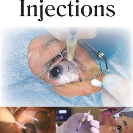 Intravitreal Injections