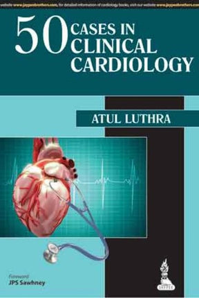 50 Cases in Clinical Cardiology