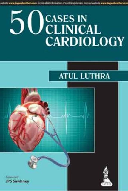 50 Cases in Clinical Cardiology