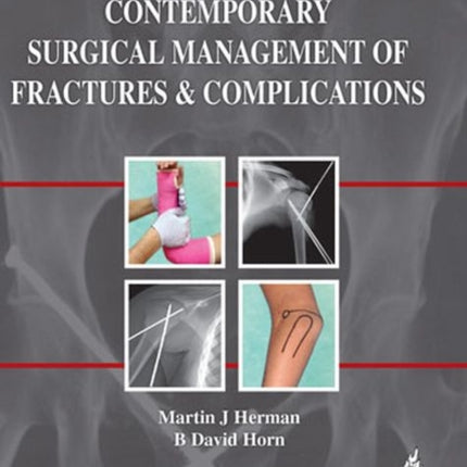 Contemporary Surgical Management of  Fractures and Complications: Volume 3 - Pediatrics