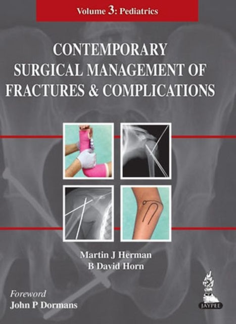 Contemporary Surgical Management of  Fractures and Complications: Volume 3 - Pediatrics