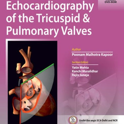 Transesophageal Echocardiography of the Tricuspid & Pulmonary Valves