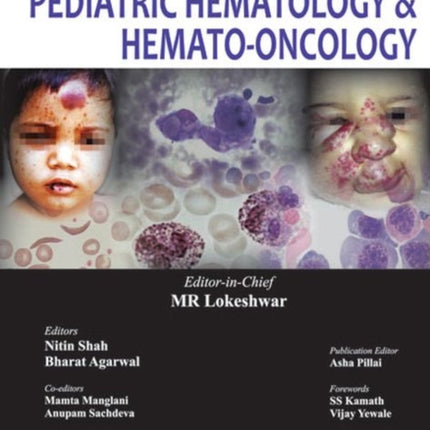 Textbook of Pediatric Hematology & Hemato-Oncology