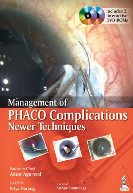 Management of Phaco Complications: Newer Techniques