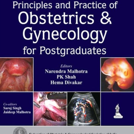 Principles and Practice of Obstetrics & Gynecology for Postgraduates