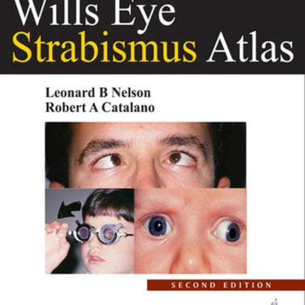 Wills Eye Strabismus Atlas