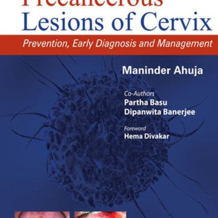 Precancerous Lesions of Cervix: Prevention, Early Diagnosis and Management