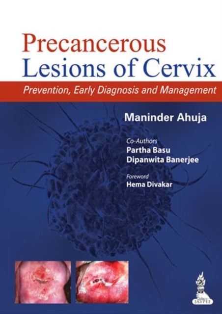 Precancerous Lesions of Cervix: Prevention, Early Diagnosis and Management