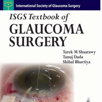 ISGS Textbook of Glaucoma Surgery