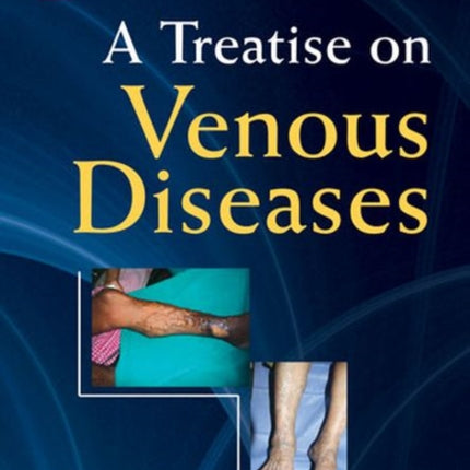 A Treatise on Venous Diseases