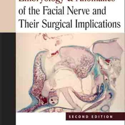 Embryology & Anomalies of the Facial Nerve and Their Surgical Implications