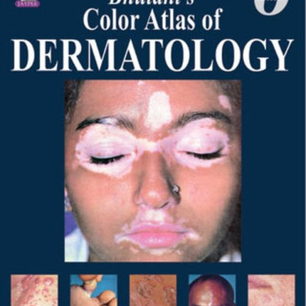 Bhutani’s  Color Atlas of Dermatology