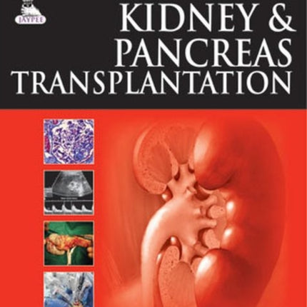 Kidney & Pancreas Transplantation