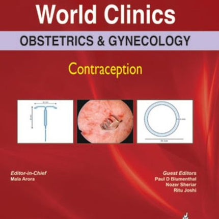 World Clinics: Obstetrics & Gynecology - Contraception Volume 3 Number 1