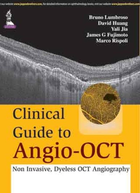 Clinical Guide to Angio-OCT: Non Invasive, Dyeless OCT Angiography