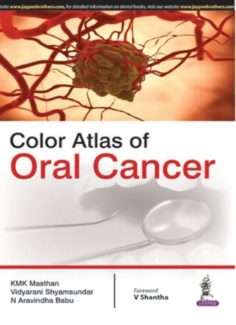 Color Atlas of Oral Cancer