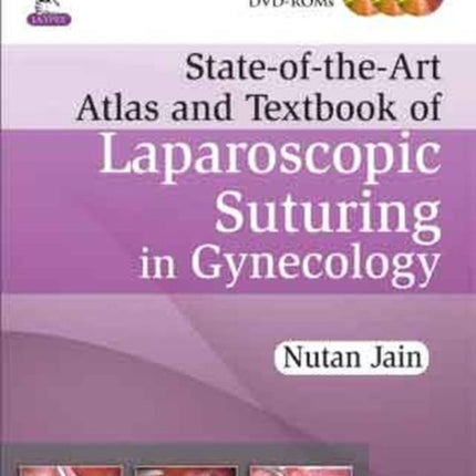 State-of-the-Art Atlas and Textbook of Laparoscopic Suturing in Gynecology