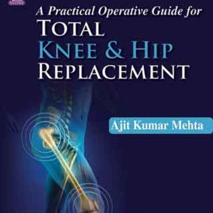 A Practical Operative Guide for Total Knee and Hip Replacement