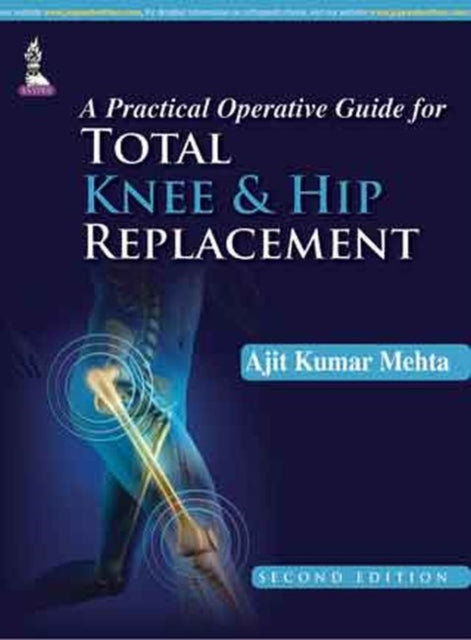 A Practical Operative Guide for Total Knee and Hip Replacement