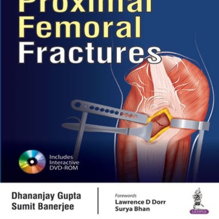 An Operative Manual of Proximal Femoral Fractures