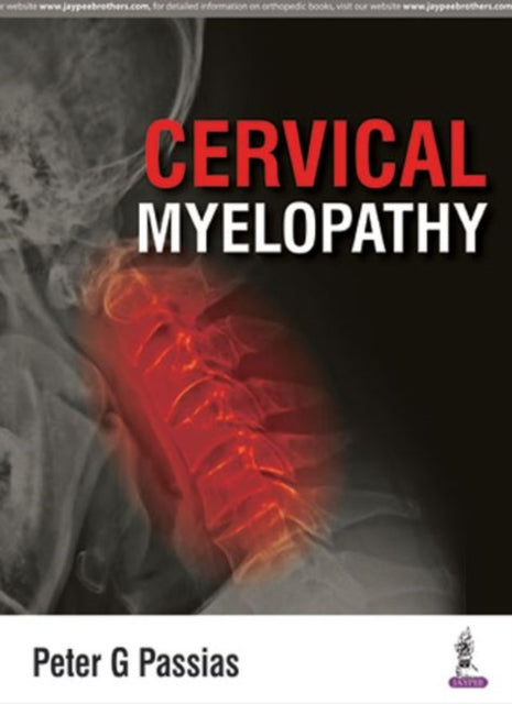 Cervical Myelopathy