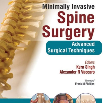 Minimally Invasive Spine Surgery