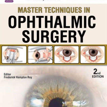 Master Techniques in Ophthalmic Surgery