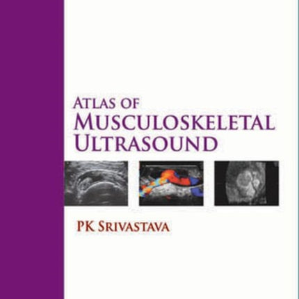 Atlas of Musculoskeletal Ultrasound