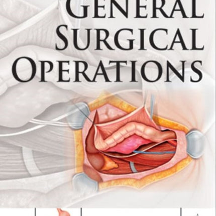 General Surgical Operations