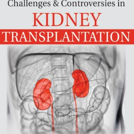 Challenges and Controversies in Kidney